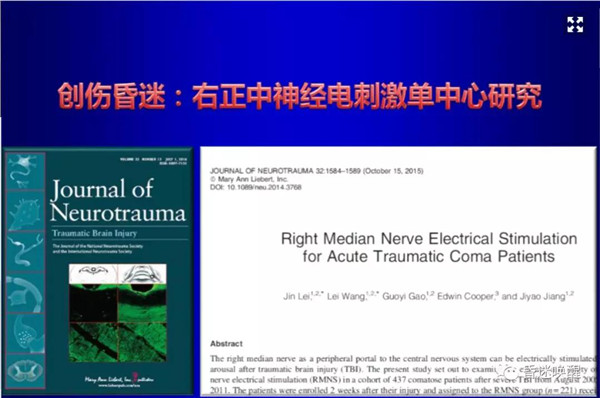 昏迷催醒新技術(shù)|右正中神經(jīng)電刺激昏迷催醒技術(shù)原理